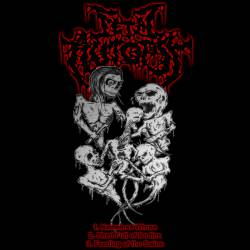 Fetal Autopsy : Demo